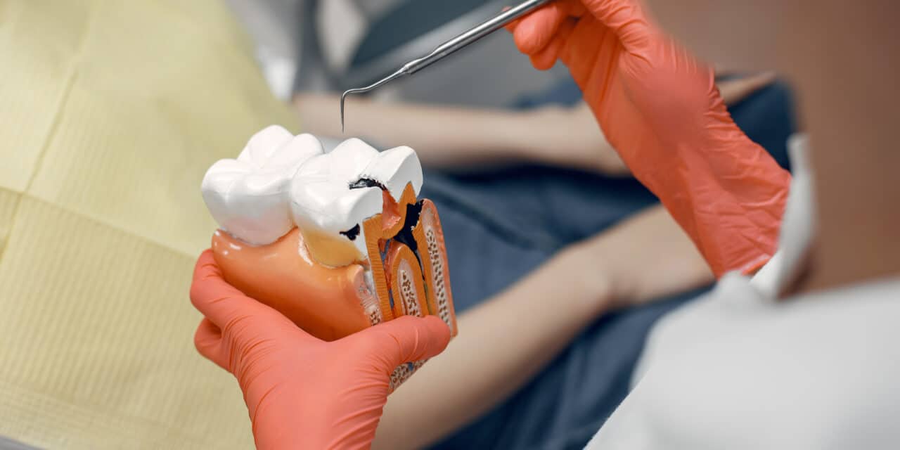 5 Things No One Tells You About Bone Grafts for Dental Implants