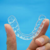Aligners