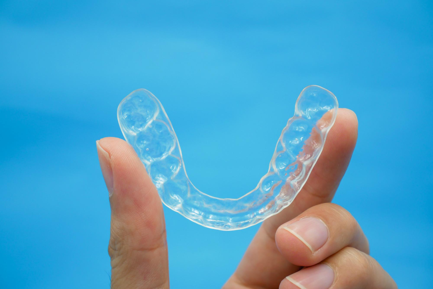 Aligners Aligners
