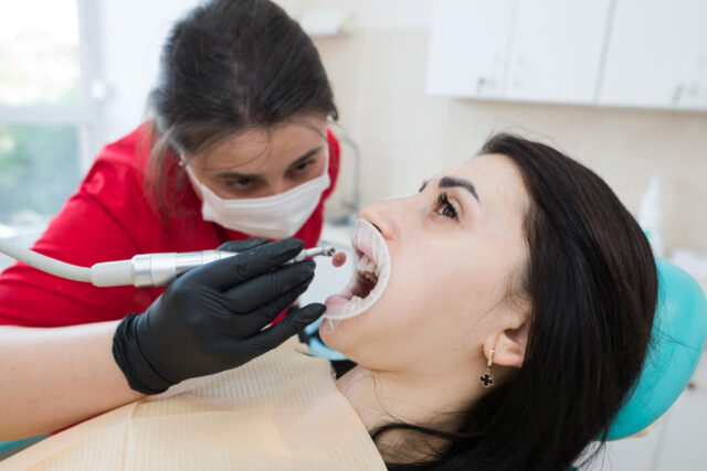 Dental Checkups