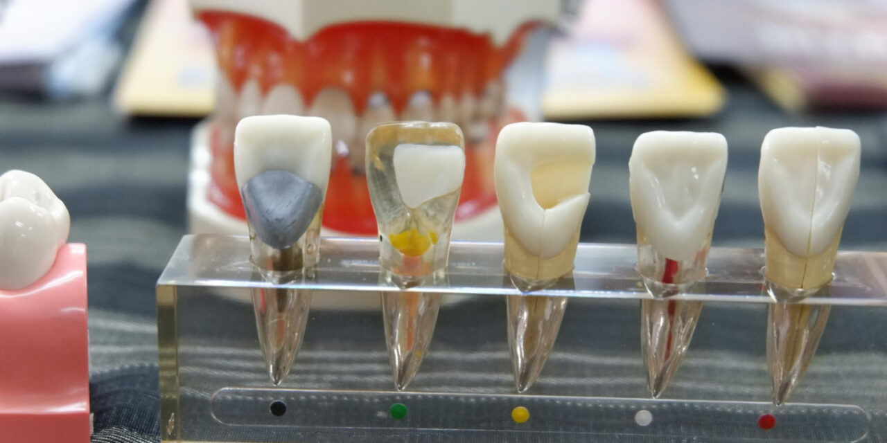 Zirconia Dental Crown Cost in Hyderabad: Procedure, Benefits & Price Guide
