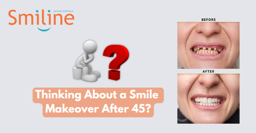 Thinking About a Smile Makeover After 45 Thinking About a Smile Makeover After 45