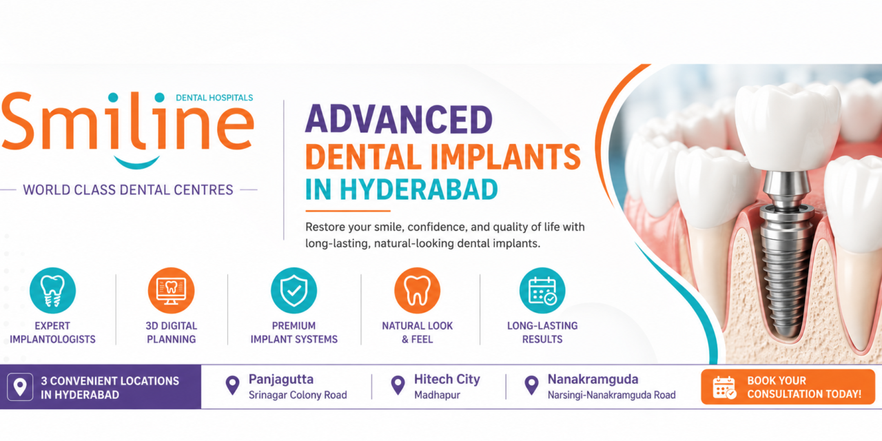 Advanced Dental Implants in Hyderabad | Smiline Dental Hospitals
