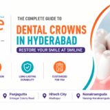 Dental crowns in Hyderabad at Smiline Dental Hospitals offering zirconia, porcelain, and E-Max crowns for restoring damaged and decayed teeth.