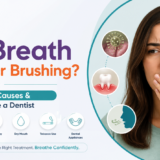 Smiline Dental Hospitals blog banner featuring a woman covering her mouth due to bad breath, with the title 'Bad Breath Even After Brushing? Common Causes & When to See a Dentist' and illustrations highlighting tongue bacteria, gum disease, tooth decay, dry mouth, tobacco use, and dental appliances.